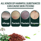 Summifun - Psoriasis Cream