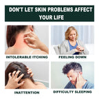 Summifun - Psoriasis Cream