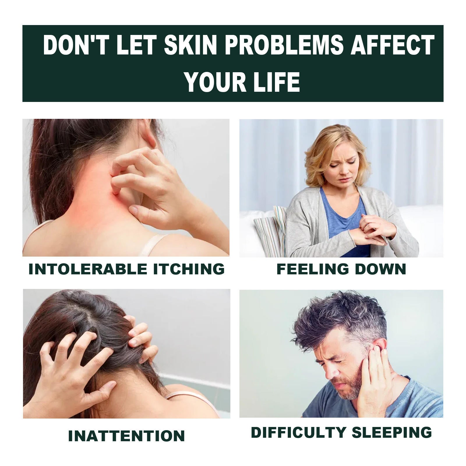 Summifun - Psoriasis Cream