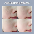 LANBENA - Pore Solution Serum (Original)