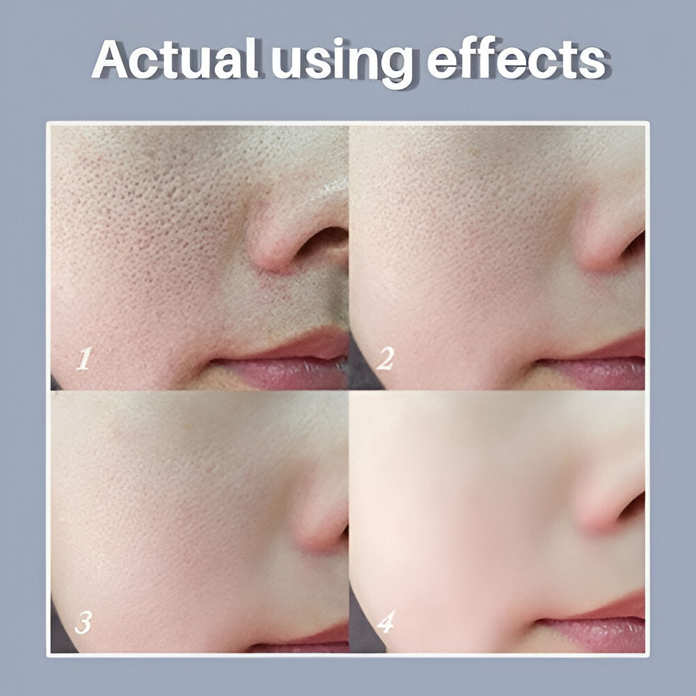 LANBENA - Pore Solution Serum (Original)